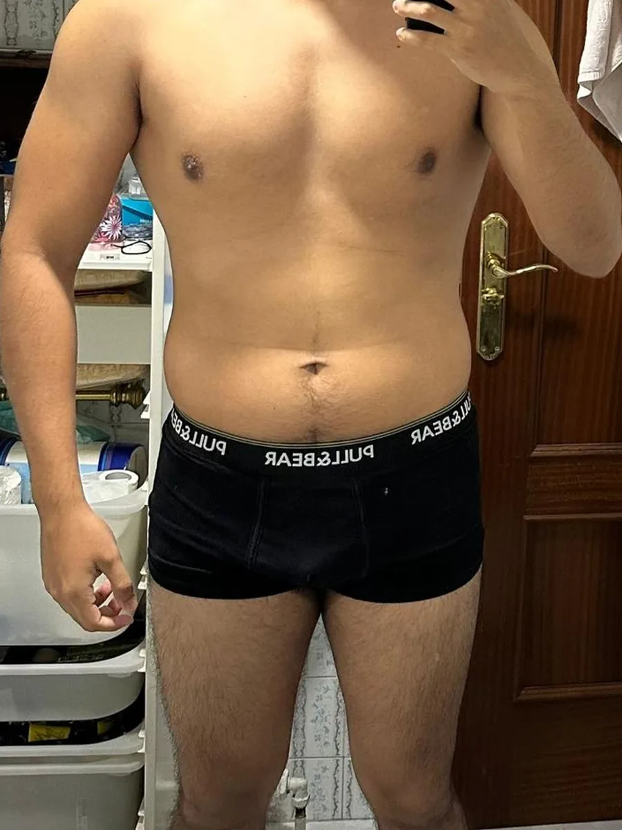 Cambio físico de un cliente de la asesoría, antes